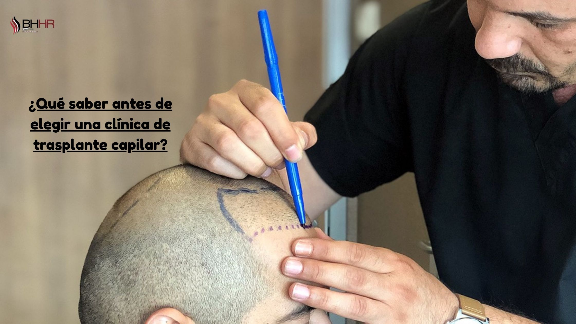 clinica de implante de cabello